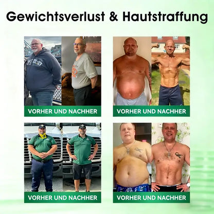 💗𝐎𝐟𝐟𝐢𝐳𝐢𝐞𝐥𝐥𝐞𝐫 𝐃𝐞𝐮𝐭𝐬𝐜𝐡𝐥𝐚𝐧𝐝-𝐒𝐡𝐨𝐩 | 🩺 𝐂𝐥𝐞𝐚𝐫𝐞𝐧𝐚® 𝐌𝐨𝐫𝐢𝐧𝐠𝐚 · 𝐁𝐞𝐫𝐛𝐞𝐫𝐢𝐧 × 𝐍𝐀𝐃+ 𝟏𝟎-𝐢𝐧-𝟏 𝐀𝐝𝐯𝐚𝐧𝐜𝐞𝐝 𝐍𝐚𝐧𝐨-𝐌𝐢𝐜𝐫𝐨𝐧𝐞𝐞𝐝𝐥𝐞-𝐏𝐟𝐥𝐚𝐬𝐭𝐞𝐫 — 𝟏× 𝐭𝐚̈𝐠𝐥𝐢𝐜𝐡, 𝐬𝐢𝐜𝐡𝐭𝐛𝐚𝐫𝐞 𝐄𝐫𝐠𝐞𝐛𝐧𝐢𝐬𝐬𝐞 𝐢𝐧 𝟕 𝐓𝐚𝐠𝐞𝐧